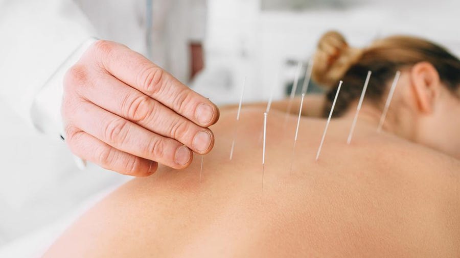 Your Top Picks For Acupuncture Needle Materials