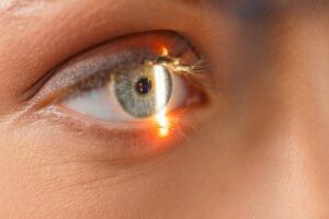 Opening Clear Vision: The Prospect of Private Retina Laser Therapy