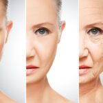 How Botox Treatments Enhance Both Beauty and Confidence in London